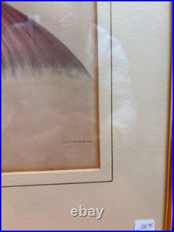 Estampe Gravure XIXème La Tête Glande Salivaire Anatomie William Bagg