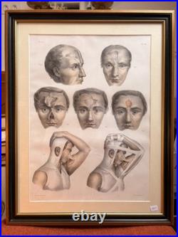 Gravure Chirurgie plastique Rhinoplastique NICOLAS HENRI Jacob Bourgery Anatomie