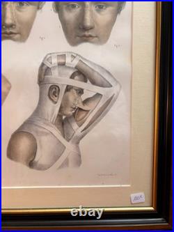 Gravure Chirurgie plastique Rhinoplastique NICOLAS HENRI Jacob Bourgery Anatomie