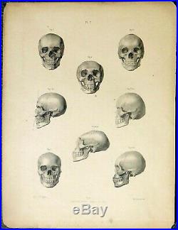 Gravure atlas anatomie docteur Fau crane ecorché squelette vanité memento mori
