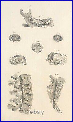 Mâchoire vertèbres coccyx facrum 1759 d'après Tarsis Ostéologie Médecine