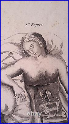 Rare curiosa gravure planche anatomie féminine curiosité médecine estampe XVIIIè
